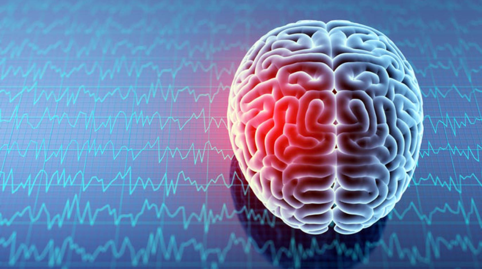Что такое эпилепсия и является ли она генетическим заболеванием?